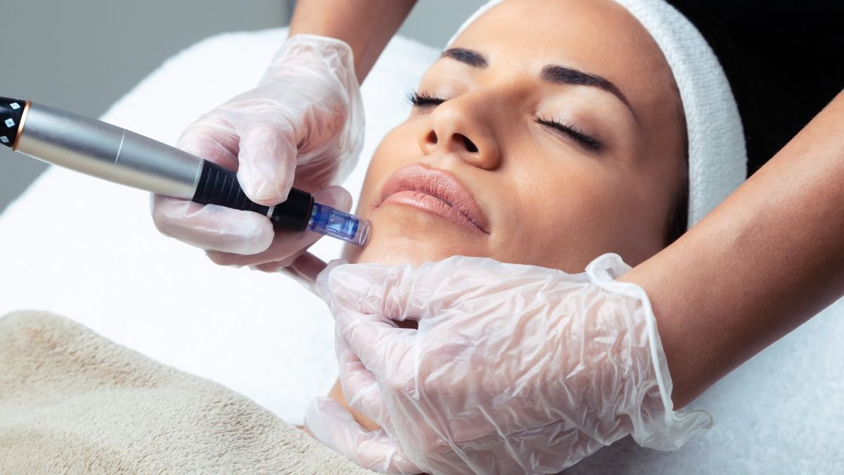 Dermapen beneficios y desventajas